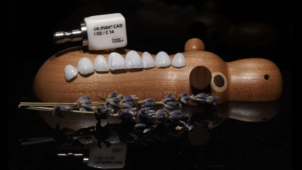 牙齒黃-牙齒矯正美白-emax瓷塊與陶瓷貼片成品-朗日牙醫-台中